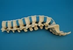 LUMBAR SPINE