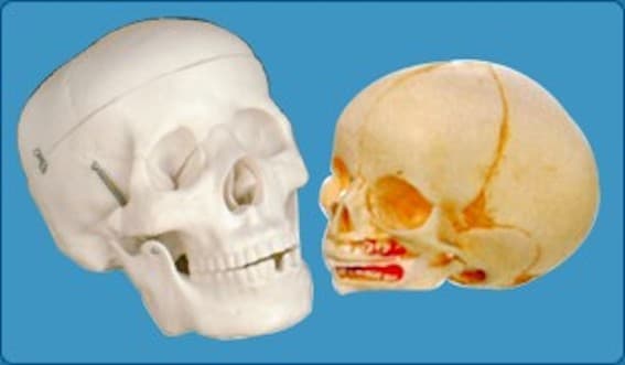 DISARTICULATED HUMAN OR CHILD SKULL